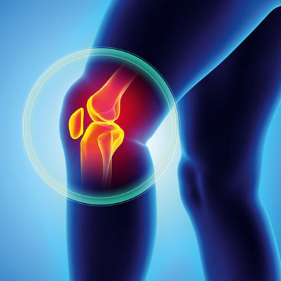 Gonartrosi (artrosi del ginocchio) 